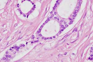 Small very regular nuclei with inconspicuous nucleoli